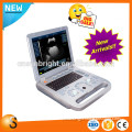 ultrasound linear probe ultrasound scanner china